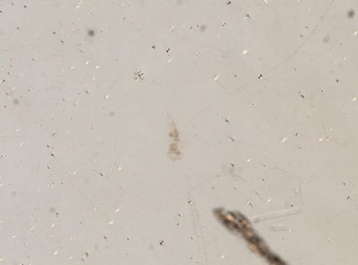 Epiphanes senta
