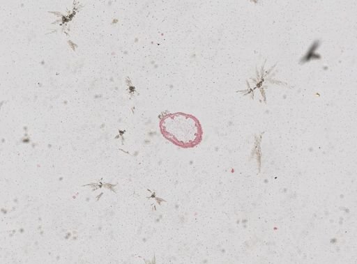 Nematostella