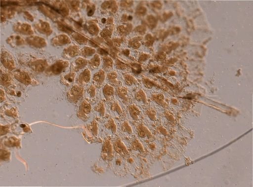 Torquatella dissimilis