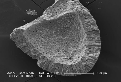 Globorotalia inflata