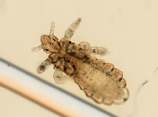 Pediculus humanus