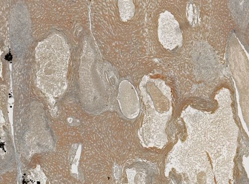 Taenia crassicollis
