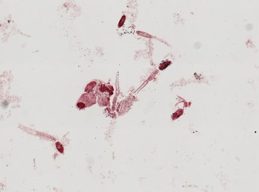 Cercaria gracillima