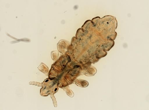 Pediculus humanus