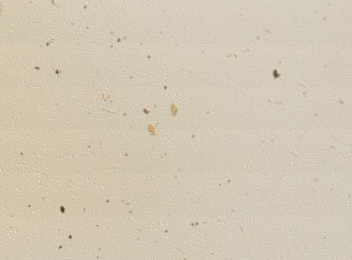 Pyrgula annulata