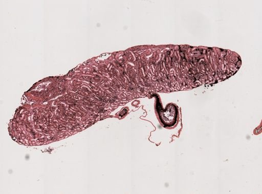 Haemogregarina