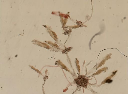 Triticella elongata