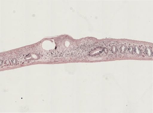 Turbellaria