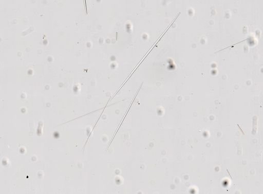 Tethya seychellensis
