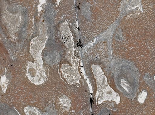 Taenia crassicollis