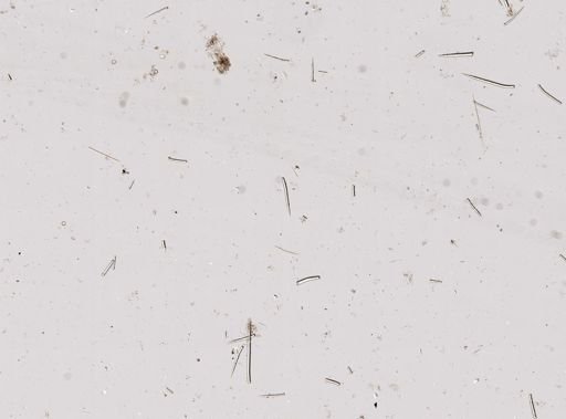 cf. Endectyon (Hemectyon)
