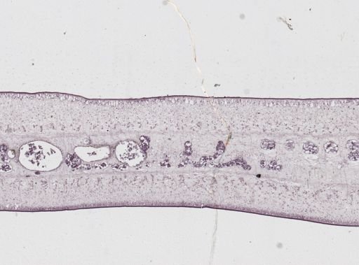 Taenia saginata