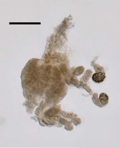 Chuniphyes multidentata