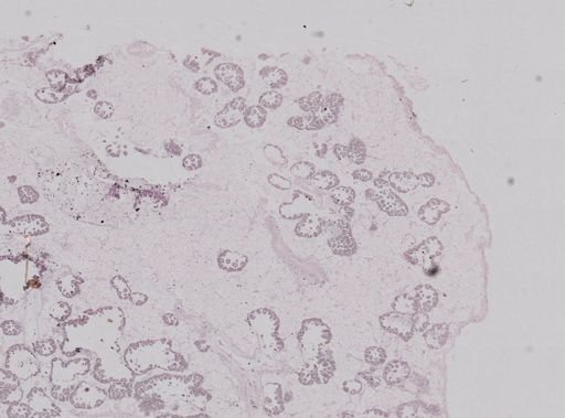 Modiolus