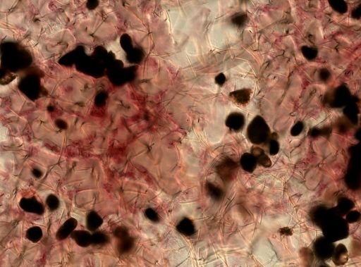 Ptilocaulis walpersii