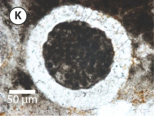 Megasphaera miniscula