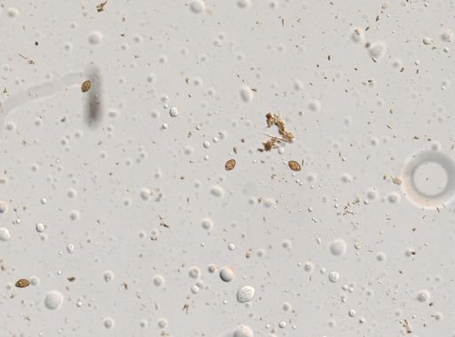 Diphyllobothrium canis