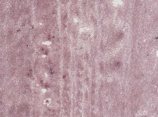 Trypanosoma lewisi
