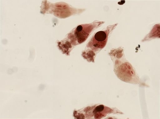 Epiphanes senta