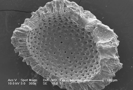 Globigerinoides sacculifer