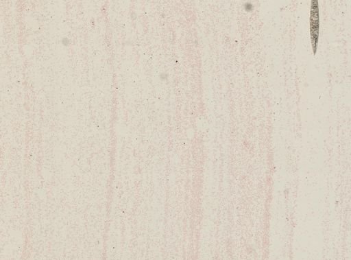 Plasmodium vivax