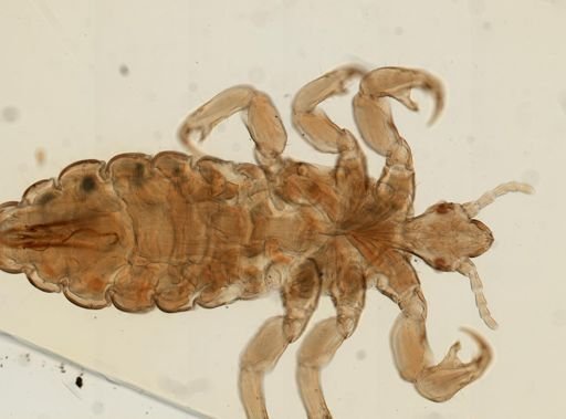 Pediculus humanus
