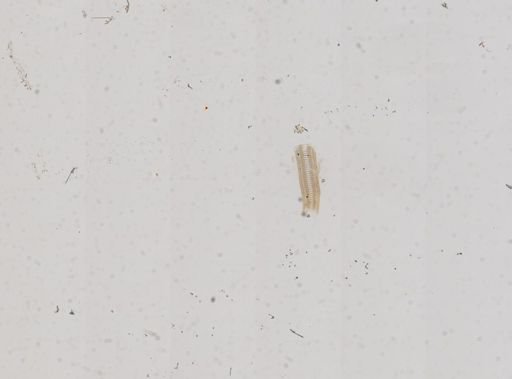 Hydrobia truncata