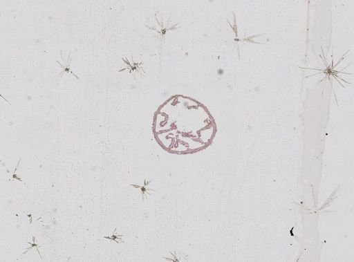 Nematostella