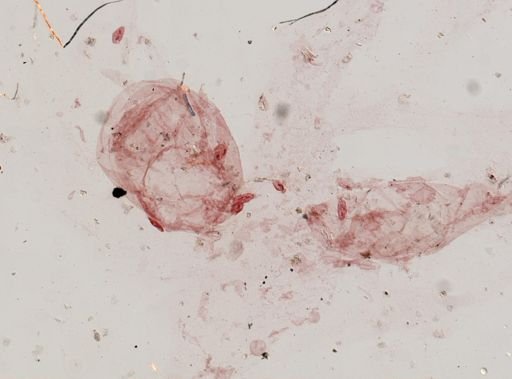 Oxytricha