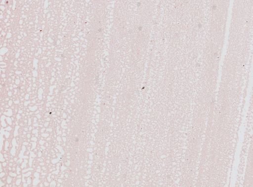 Plasmodium vivax