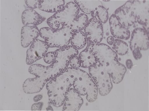 Paracentrotus lividus