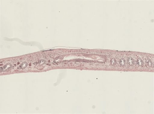 Turbellaria