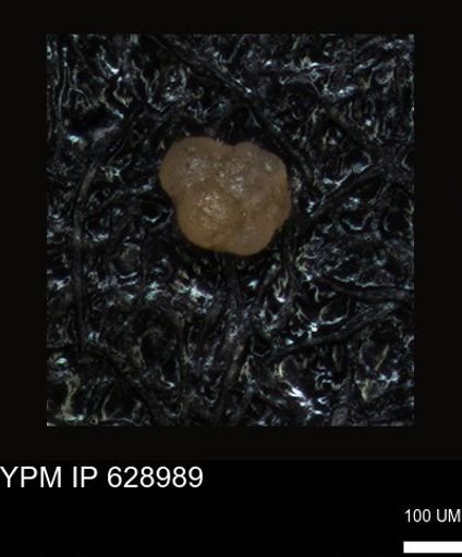 undet. Foraminiferida