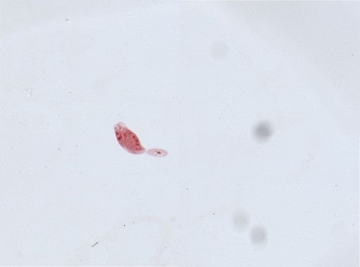 Woodruffia metabolica