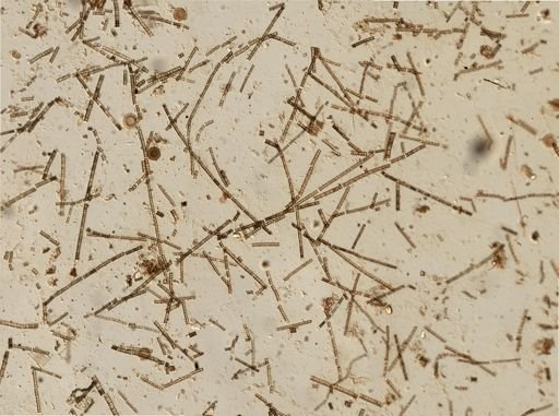 Bacillariophyceae