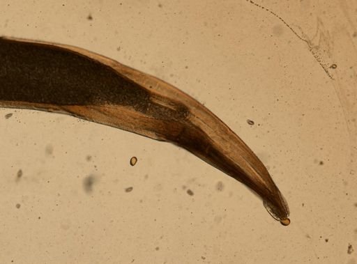 Enterobius vermicularis