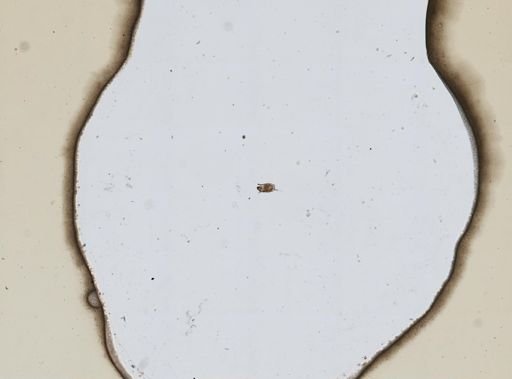 Keratella valga asymetrica