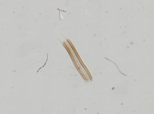 Bithynia tentaculata