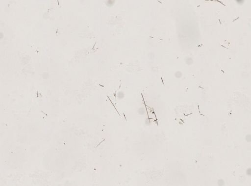 Clathria (Microciona) sp.