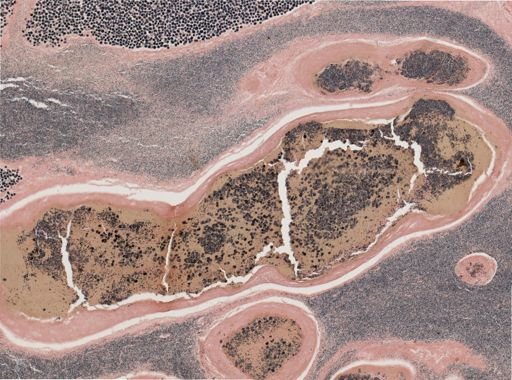 Ichthyosporidium