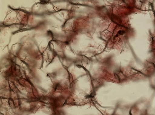 Isodictya deichmannae