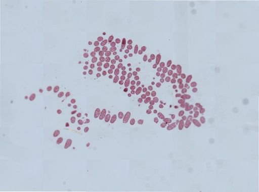 Chironomus