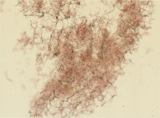 Haliclona oculata