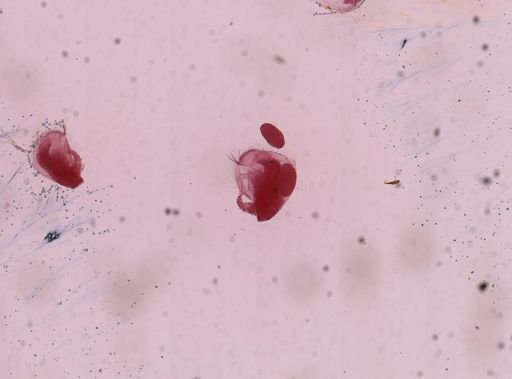 Cladocera