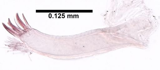 Tanaidacea