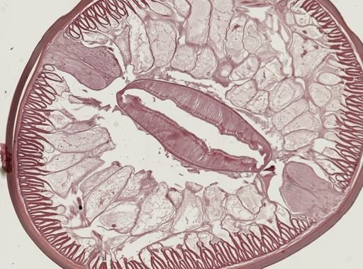 Ascaris lumbricoides
