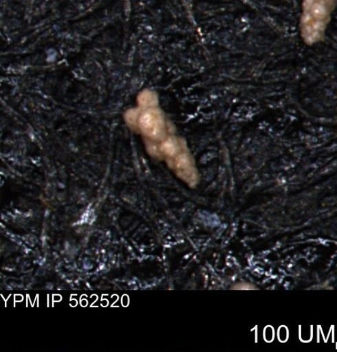 Verneuilina canadensis