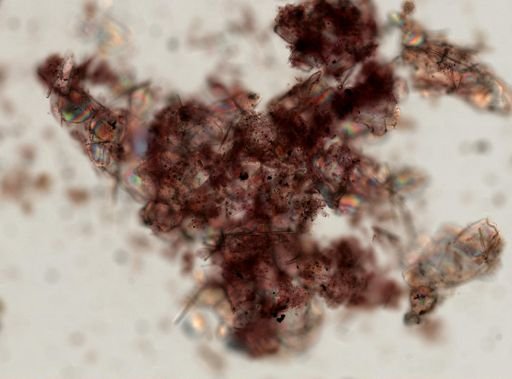 Keratosa