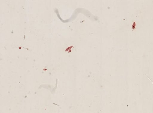 Paramecium
