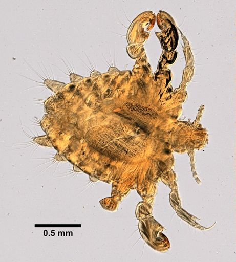 Pthirus pubis